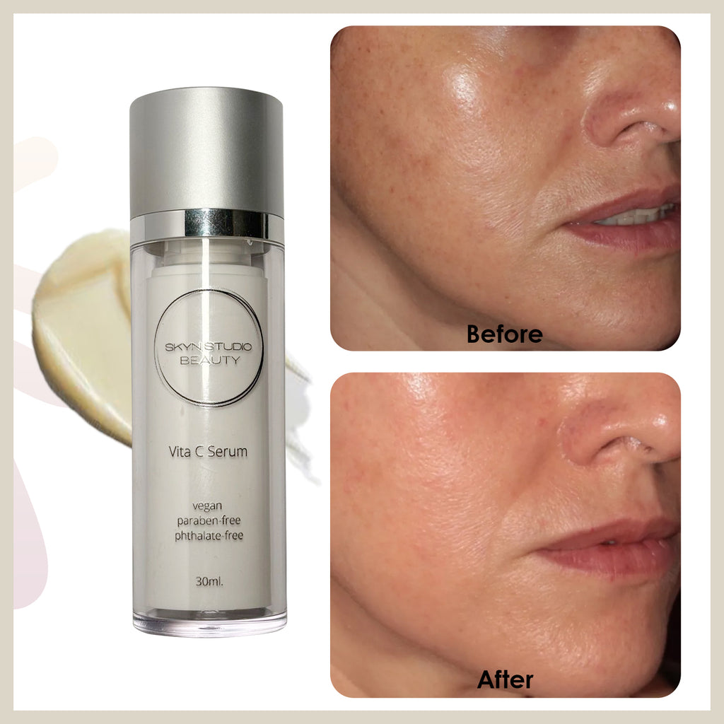 Vita C Serum